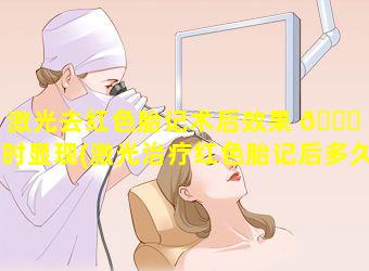 激光去红色胎记术后效果 🐅 何时显现(激光治疗红色胎记后多久能看出效果)